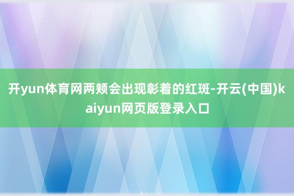 开yun体育网两颊会出现彰着的红斑-开云(中国)kaiyun网页版登录入口